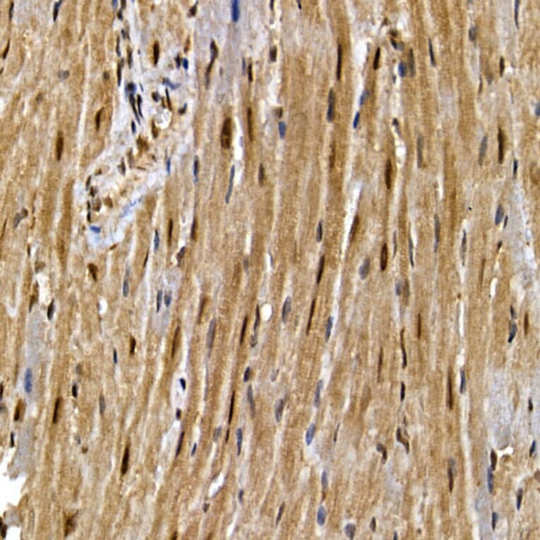 Immunohistochemistry - Anti-PPAR gamma Antibody (A12590) - Antibodies.com