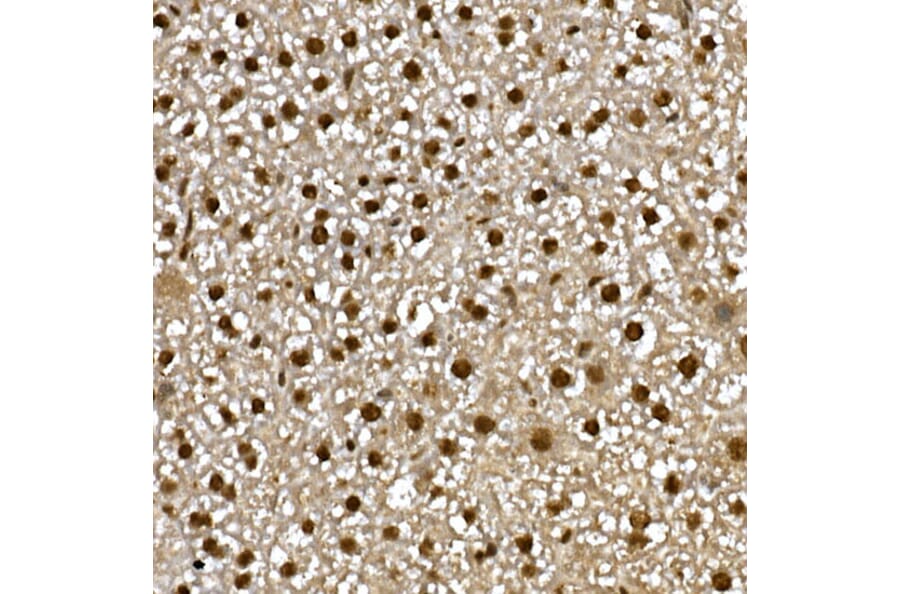 Immunohistochemistry - Anti-PPAR gamma Antibody (A12590) - Antibodies.com