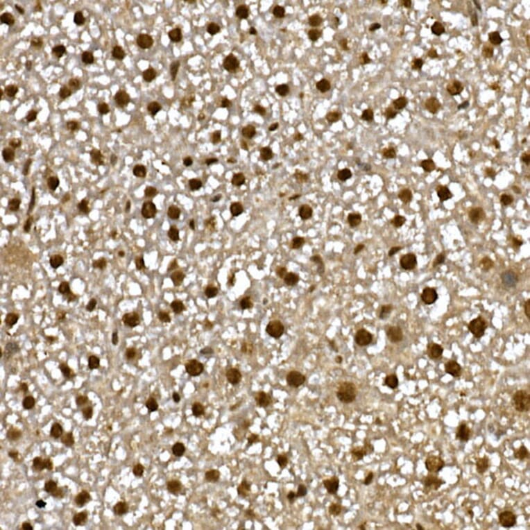 Immunohistochemistry - Anti-PPAR gamma Antibody (A12590) - Antibodies.com
