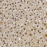 Immunohistochemistry - Anti-PPAR gamma Antibody (A12590) - Antibodies.com