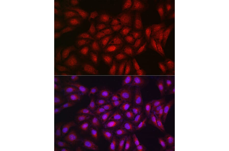 Immunofluorescence - Anti-PPAR gamma Antibody (A12590) - Antibodies.com