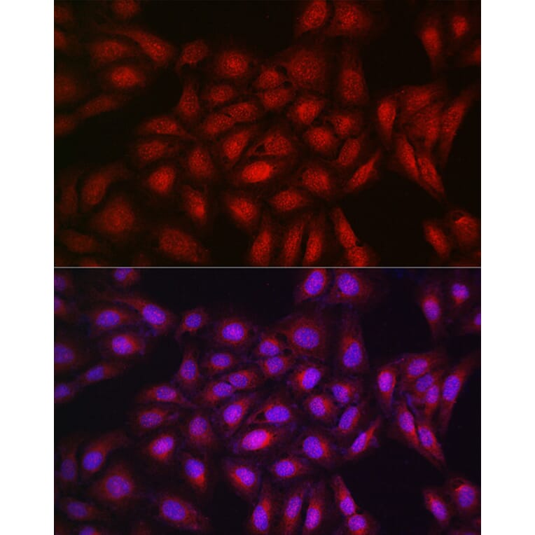 Immunofluorescence - Anti-PPAR gamma Antibody (A12590) - Antibodies.com