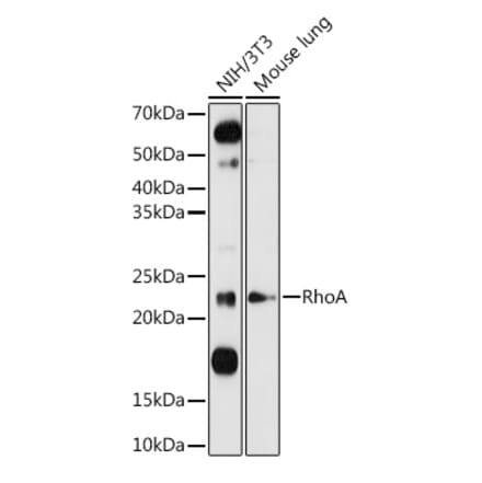 Western Blot - Anti-RhoA Antibody (A12591) - Antibodies.com