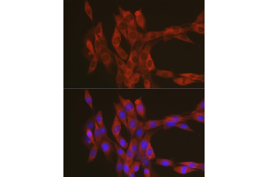 Immunofluorescence - Anti-RhoA Antibody (A12591) - Antibodies.com