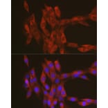 Immunofluorescence - Anti-RhoA Antibody (A12591) - Antibodies.com