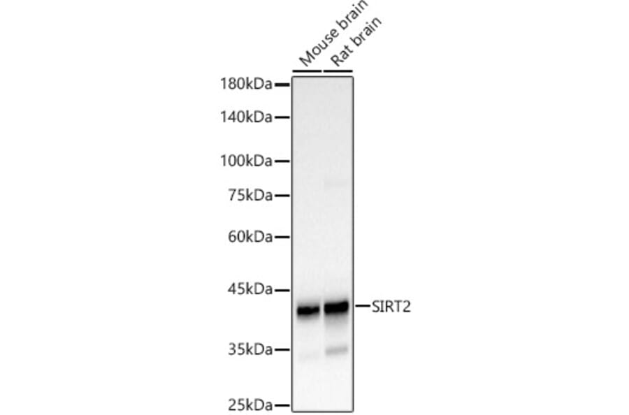 Western Blot - Anti-SIRT2 Antibody (A12592) - Antibodies.com