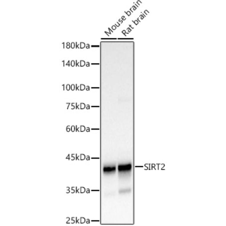 Western Blot - Anti-SIRT2 Antibody (A12592) - Antibodies.com