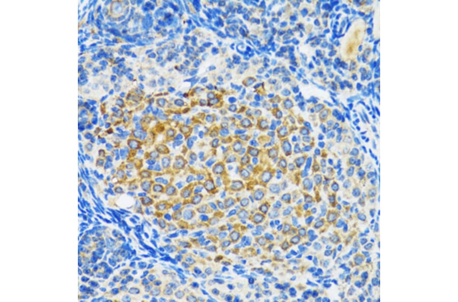 Immunohistochemistry - Anti-SIRT2 Antibody (A12592) - Antibodies.com