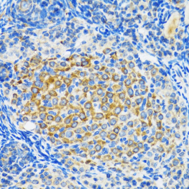 Immunohistochemistry - Anti-SIRT2 Antibody (A12592) - Antibodies.com