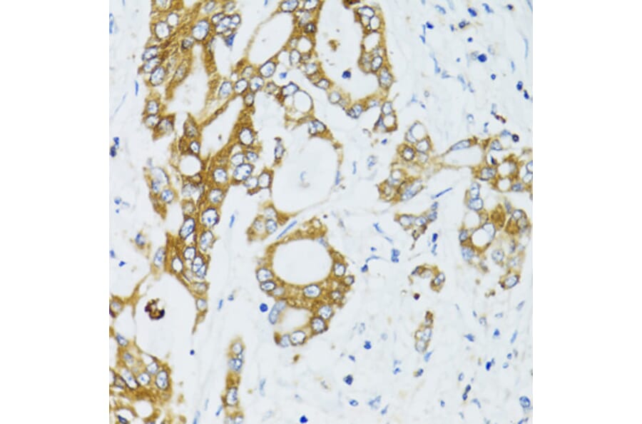 Immunohistochemistry - Anti-SIRT2 Antibody (A12592) - Antibodies.com