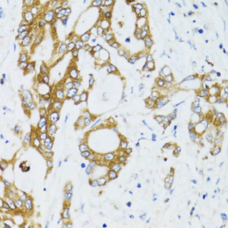 Immunohistochemistry - Anti-SIRT2 Antibody (A12592) - Antibodies.com