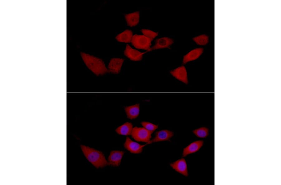 Immunofluorescence - Anti-SIRT2 Antibody (A12592) - Antibodies.com