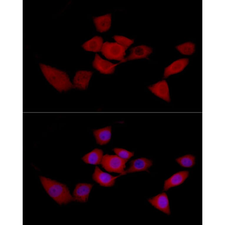 Immunofluorescence - Anti-SIRT2 Antibody (A12592) - Antibodies.com