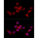 Immunofluorescence - Anti-SIRT2 Antibody (A12592) - Antibodies.com