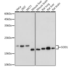 Western Blot - Anti-Superoxide Dismutase 1 Antibody (A12593) - Antibodies.com