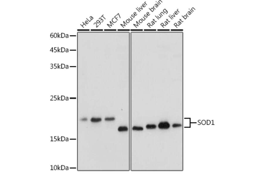 Western Blot - Anti-Superoxide Dismutase 1 Antibody (A12593) - Antibodies.com