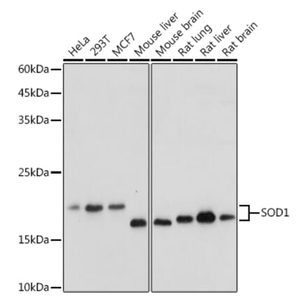 Western Blot - Anti-Superoxide Dismutase 1 Antibody (A12593) - Antibodies.com
