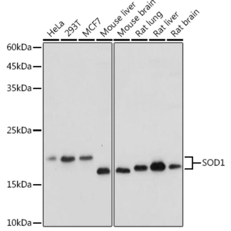 Western Blot - Anti-Superoxide Dismutase 1 Antibody (A12593) - Antibodies.com