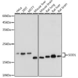 Western Blot - Anti-Superoxide Dismutase 1 Antibody (A12593) - Antibodies.com