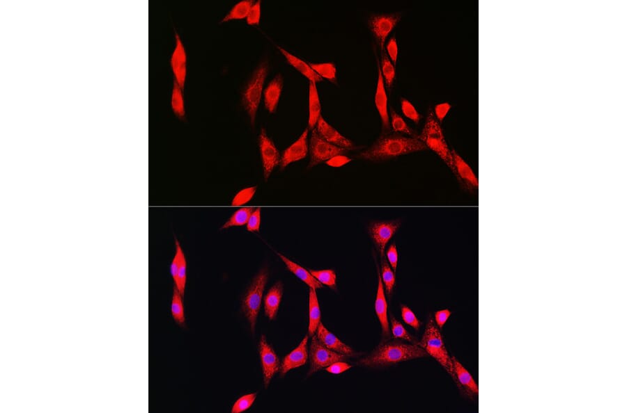 Immunofluorescence - Anti-Superoxide Dismutase 1 Antibody (A12593) - Antibodies.com