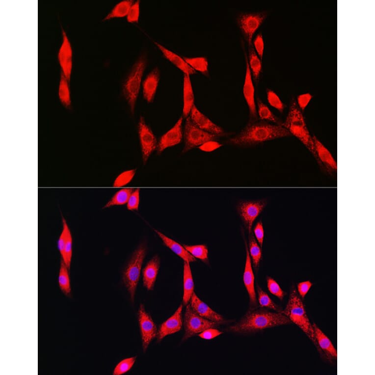 Immunofluorescence - Anti-Superoxide Dismutase 1 Antibody (A12593) - Antibodies.com