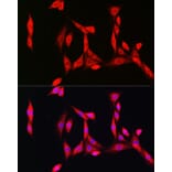 Immunofluorescence - Anti-Superoxide Dismutase 1 Antibody (A12593) - Antibodies.com