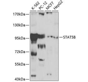 Western Blot - Anti-STAT5 Antibody (A12594) - Antibodies.com