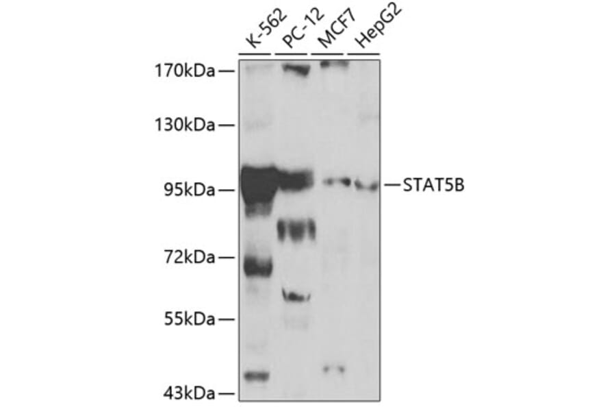 Western Blot - Anti-STAT5 Antibody (A12594) - Antibodies.com