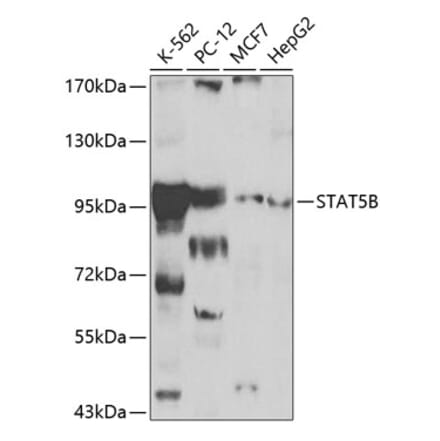 Western Blot - Anti-STAT5 Antibody (A12594) - Antibodies.com
