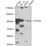 Western Blot - Anti-STAT5 Antibody (A12594) - Antibodies.com