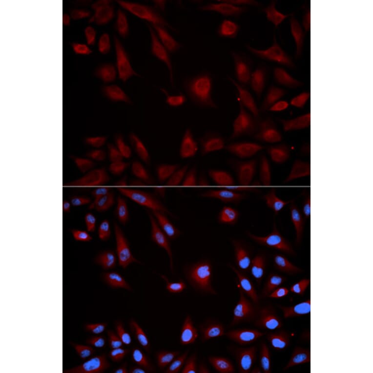 Immunofluorescence - Anti-STAT5 Antibody (A12594) - Antibodies.com