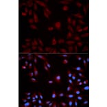 Immunofluorescence - Anti-STAT5 Antibody (A12594) - Antibodies.com