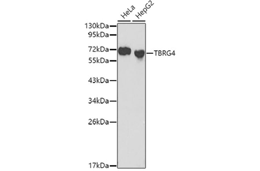 Western Blot - Anti-TBRG4 Antibody (A0276) - Antibodies.com