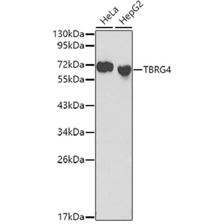 Western Blot - Anti-TBRG4 Antibody (A0276) - Antibodies.com