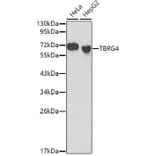 Western Blot - Anti-TBRG4 Antibody (A0276) - Antibodies.com
