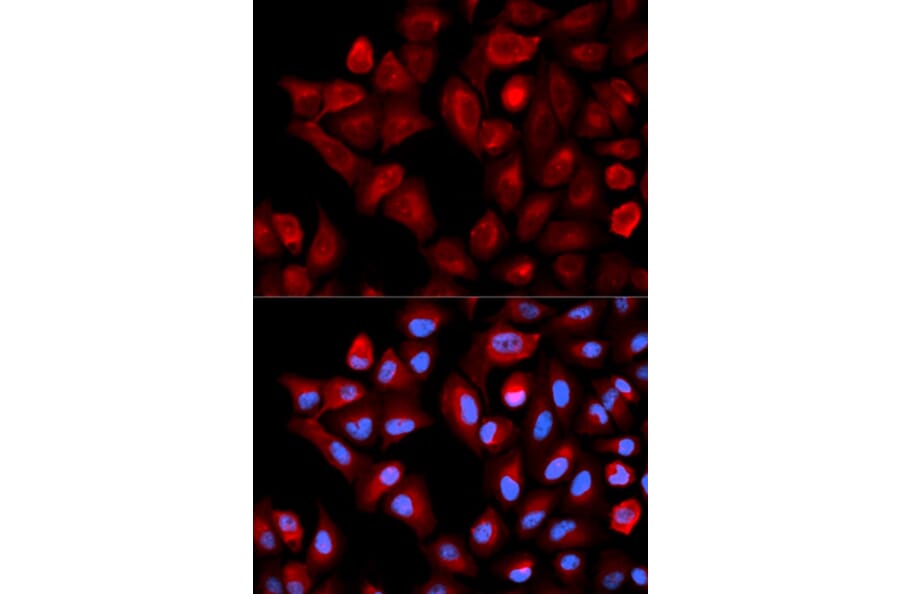 Immunofluorescence - Anti-TBRG4 Antibody (A0276) - Antibodies.com