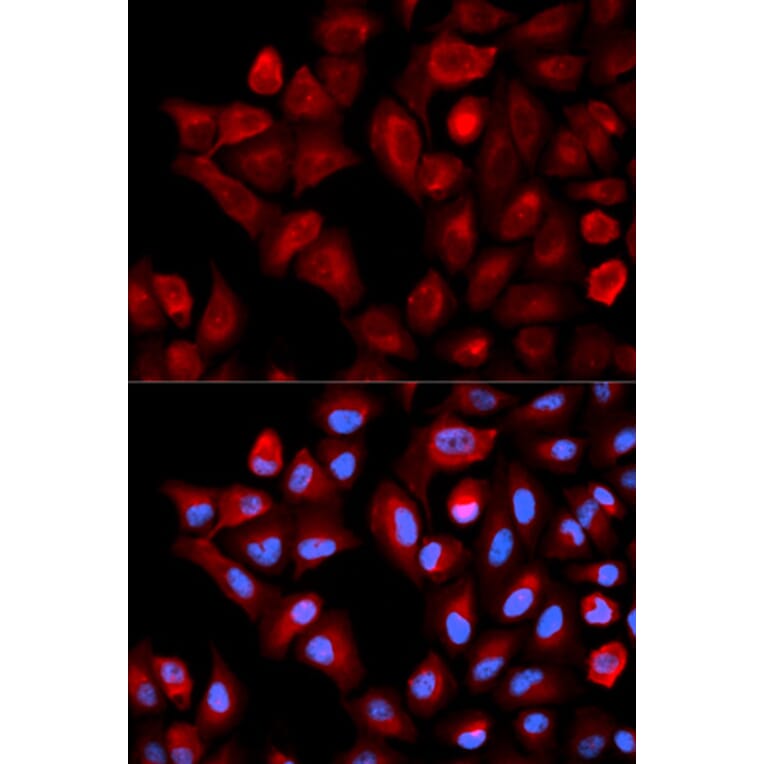 Immunofluorescence - Anti-TBRG4 Antibody (A0276) - Antibodies.com