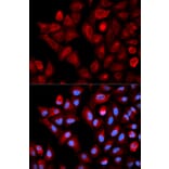 Immunofluorescence - Anti-TBRG4 Antibody (A0276) - Antibodies.com