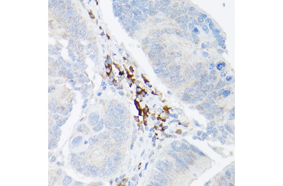 Immunohistochemistry - Anti-TNF alpha Antibody (A12596) - Antibodies.com