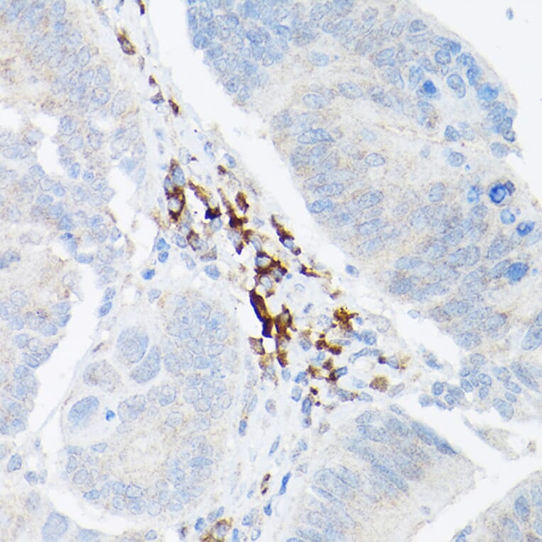 Immunohistochemistry - Anti-TNF alpha Antibody (A12596) - Antibodies.com