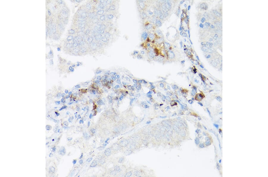 Immunohistochemistry - Anti-TNF alpha Antibody (A12596) - Antibodies.com