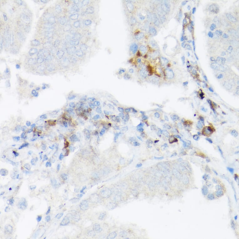 Immunohistochemistry - Anti-TNF alpha Antibody (A12596) - Antibodies.com