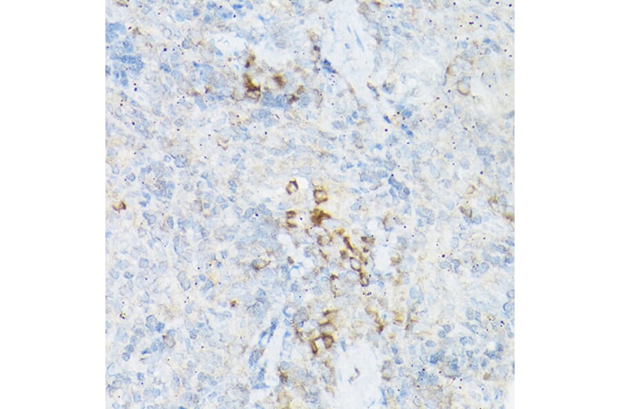 Immunohistochemistry - Anti-TNF alpha Antibody (A12596) - Antibodies.com
