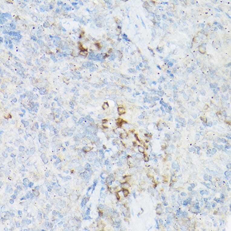 Immunohistochemistry - Anti-TNF alpha Antibody (A12596) - Antibodies.com