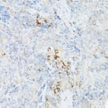 Immunohistochemistry - Anti-TNF alpha Antibody (A12596) - Antibodies.com