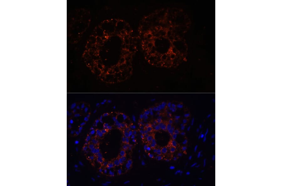 Immunofluorescence - Anti-TNF alpha Antibody (A12596) - Antibodies.com