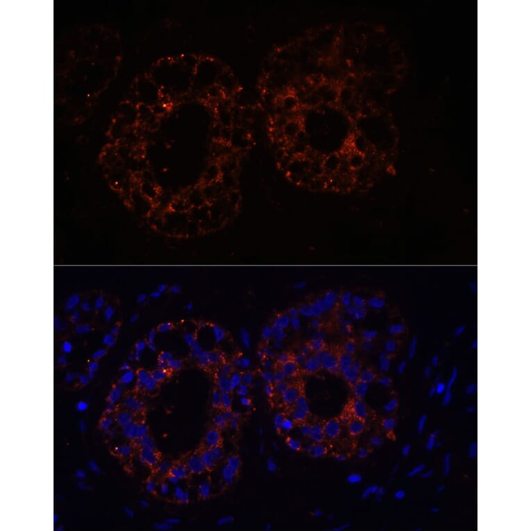 Immunofluorescence - Anti-TNF alpha Antibody (A12596) - Antibodies.com