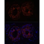 Immunofluorescence - Anti-TNF alpha Antibody (A12596) - Antibodies.com
