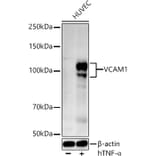 Western Blot - Anti-VCAM1 Antibody (A12598) - Antibodies.com