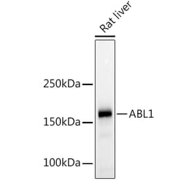 Western Blot - Anti-ABL1 Antibody (A12600) - Antibodies.com